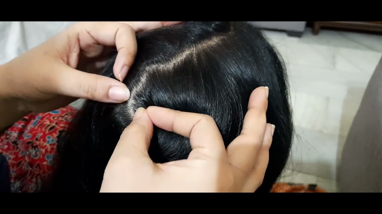 😊🌜#scalpcheck #grooming #scalpcheckasmr #haircombing #dandruffremoval #tickremoval #whitehairremoval