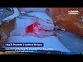 Prostatectomy Training Simulator | Realistic Urology Skills | ALDAVER