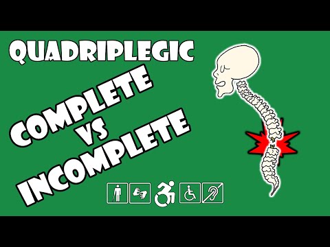 Complete vs Incomplete Spinal Cord Injury Explained | Quadriplegic (C5,C6,C7)