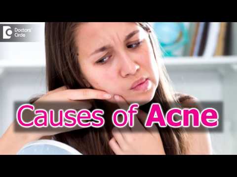 Who gets acne: Acne age | Acne prone skin - Dr. Kavitha Mandal G V