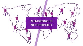 What is Membronous Nephropathy?