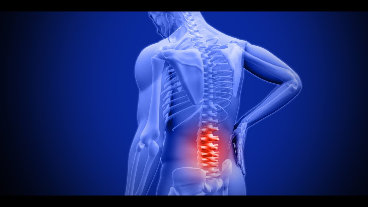 كيف يدمر المريض فقراته القطنيه - اد / محمد يسرى - علاج الغضروف و الركبه بدون جراحه