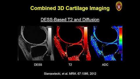 ISMRM MR Academy - Acceleration Methods for Musculoskeletal Imaging