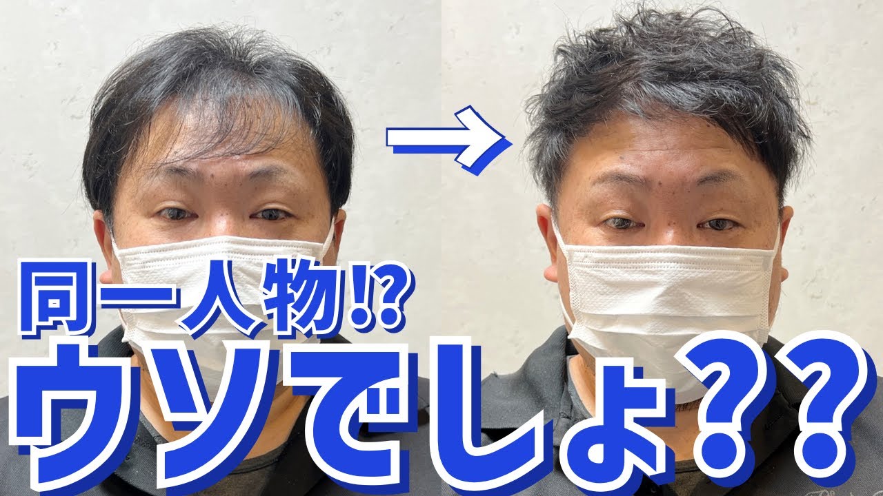 薄毛 頭頂部ハゲと前髪をカットでカバー Youtube