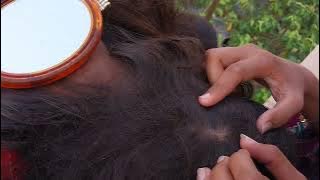 Nitpicking ASMR video 117