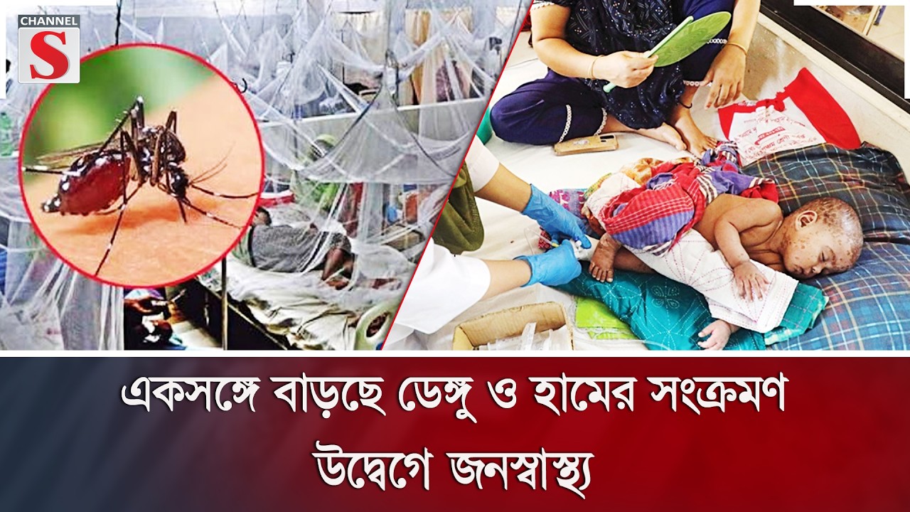 একসঙ্গে বাড়ছে ডেঙ্গু ও হামের সংক্রমণ, উদ্বেগে জনস্বাস্থ্য | Channel S News