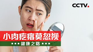 皮肤长出的肉疙瘩 你处理对了吗？20240426 小肉疙瘩莫忽视 | CCTV科教《健康之路》