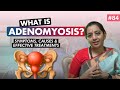 What is Adenomyosis? Symptoms, Causes &amp; Effective Treatments | Mamata Fertility Hospital, Hyderabad