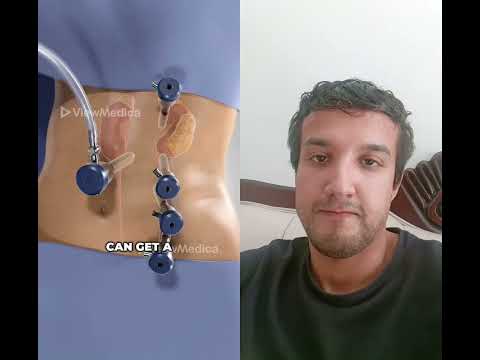 شاهدوا في الفيديو كيف تتم عملية استئصال الكلى تخذير اشتراك بالقناة اكسبلور  لايك