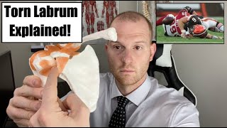 Baker Mayfield Injury Update!  Baker Mayfield Shoulder Injury