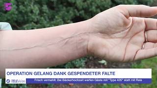Frau lässt sich Lebenslinie chirurgisch verlängern (Postillon TELEvision | Folge 14)