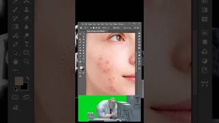 Photoshop 2026 - 1 Click Remove Acne in Photoshop - Photoshop hacks #short