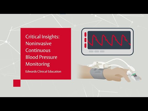 Critical Insights: Noninvasive Continuous Blood Pressure Monitoring 