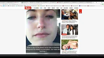 Toxic mist hits beach resort in UK  source  undisclosed thumbnail