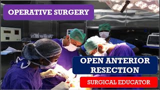 OPEN ANTERIOR RESECTION /STEP BY STEP OPERATIVE SURGERY