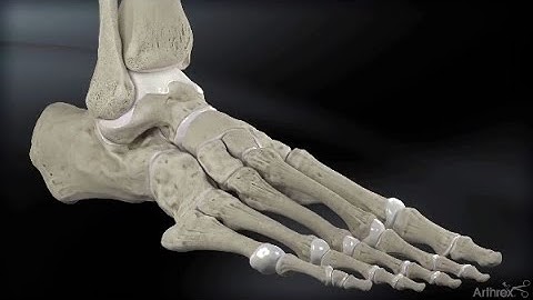 Lateral Ankle Reconstruction