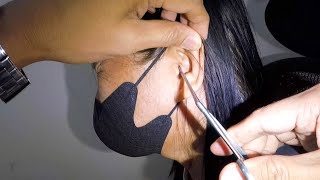 Cockroach STUCK in Woman's EAR Removed Piece by Piece by Earwax Specialist 14,880 views 1 month ago 1 minute, 50 seconds