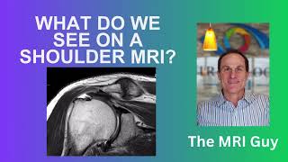 What do we see on a shoulder MRI?