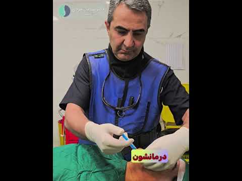 دکتر سیامک مرادی فوق تخصص درد رادیوفرکوئنسی عصب سه قلو