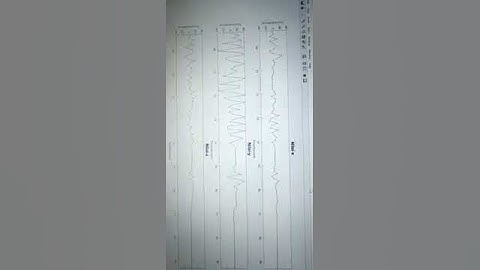 Adxl335 With matlab & Arduino UNO