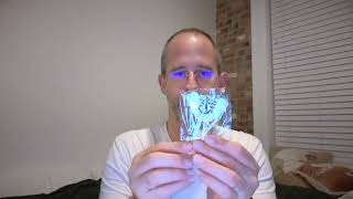 SmartGuard Anti Snore Device. New Customizable Snore Reducing Mouthpiece review