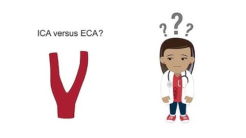 Distinguishing the ICA from the ECA with ultrasound
