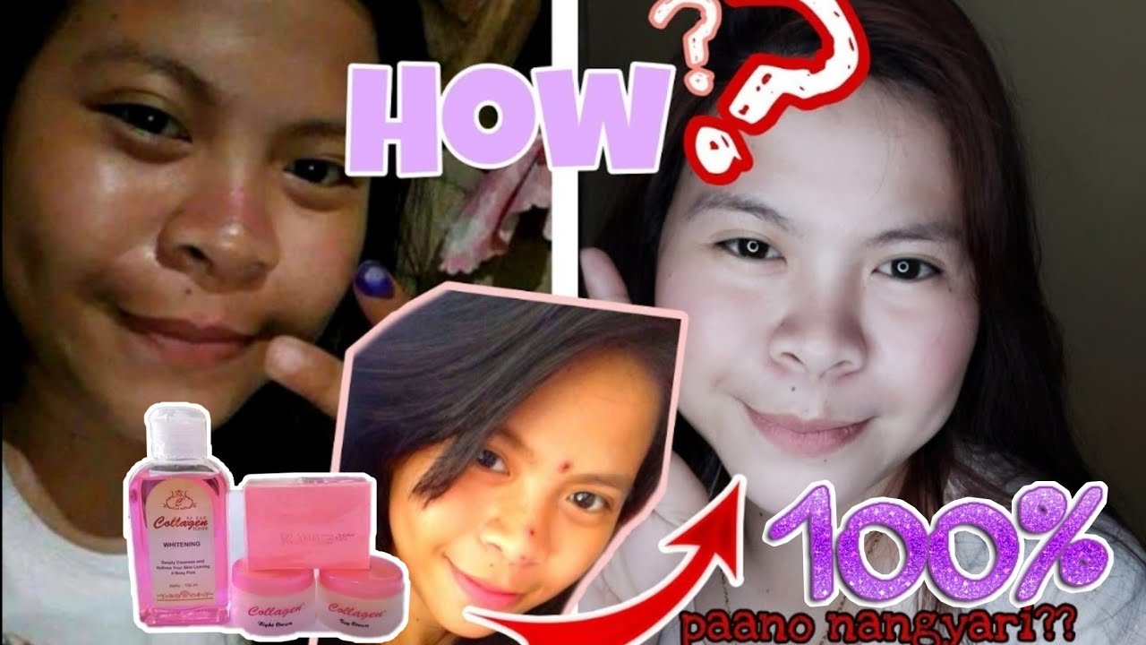 COLLAGEN SET HONEST REVIEW by GERMABLEZA