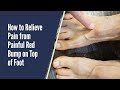 PAIN RELIEF FOR RED BUMP ON TOP OF FOOT