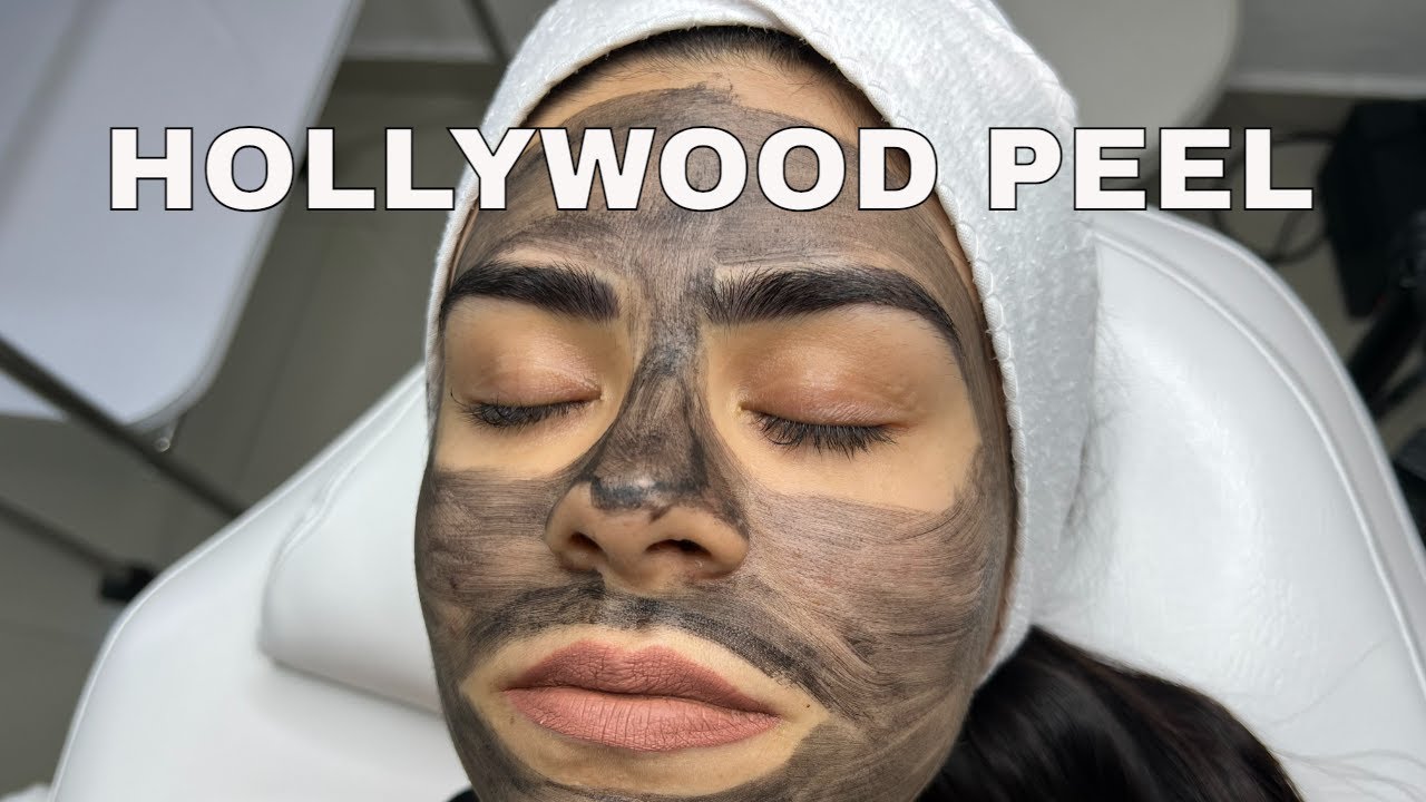 Tratamiento para rejuvenecer el rostro  *Antienvejecimiento* | ¿Qué es el Hollywood Peel?