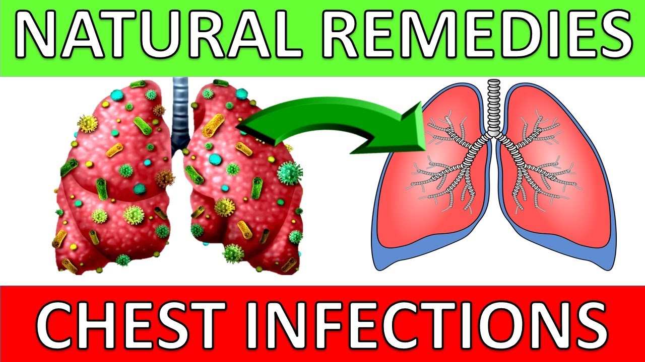 5 Natural Chest Infection Treatments (Home Remedies) YouTube