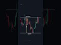 How to Master Support & Resistance Levels (All You Need to Know)