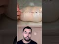 واواوا آش دار