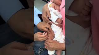 Baby Vaccination, Baby Craig Cute Baby