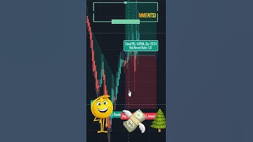 Head and Shoulders Down 1000% profitable pattern | #shorts #trending #gold #trading #forextrading