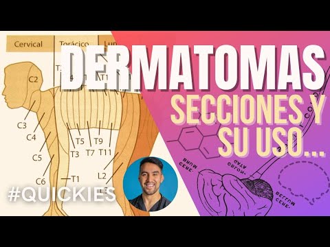 Dermatomas: Análisis desde la Neurociencia
