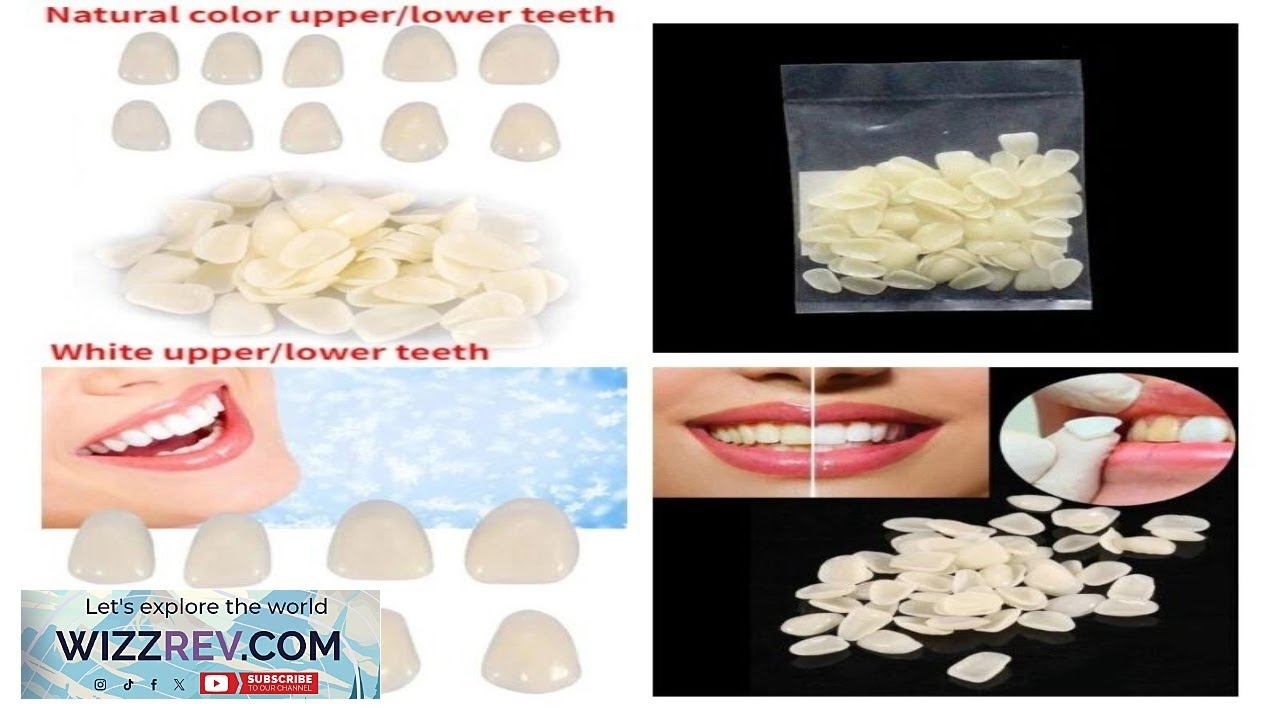 Dental Veneers Upper Lower Anterior Mixed Ultra Thin Resin Teeth Whitening eBay