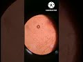 Semen microscopy| How motile sperm cell appear under Microscope