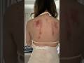 gua sha 😳