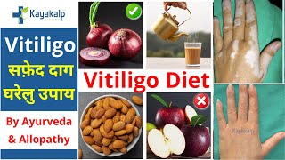 Vitiligo Diet & Home Remedies| सफेद दाग में क्या खाएं क्या न खाए| सफेद दाग के घरेलू उपचार | Kayakalp