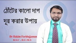 ঠোঁটের কালো দাগ দূর করার সবচেয়ে কার্যকারী চিকিৎসা পদ্ধতি । Remove the black spot  of lip screenshot 1