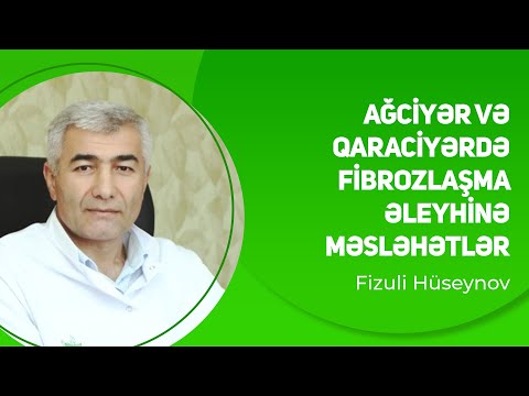 Video: İdiopatik ağciyər fibrozu müalicə edilə bilərmi?