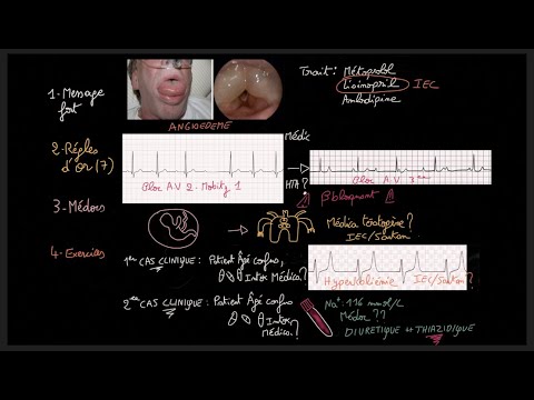 Vidéo: Abordabilité Du Traitement De L'hypertension Et Du Diabète Et Dépenses Publiques Suite à Des Changements Dans Le Partage Des Coûts Pour Les Patients Dans Le Cadre Du Programme