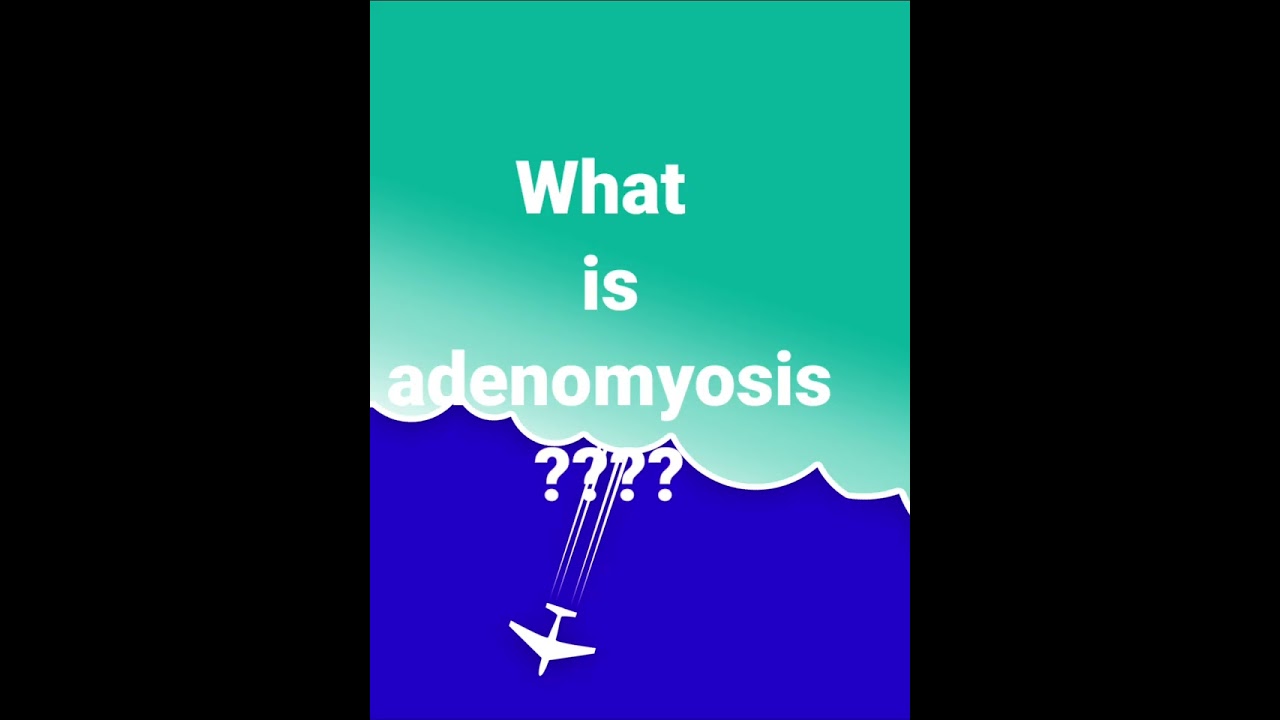 Do they ask this in viva ? 💃😮😣