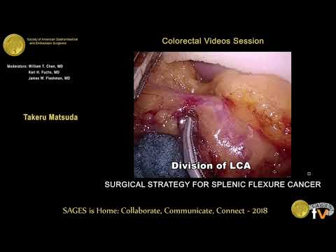 Surgical strategy for splenic flexure cancer