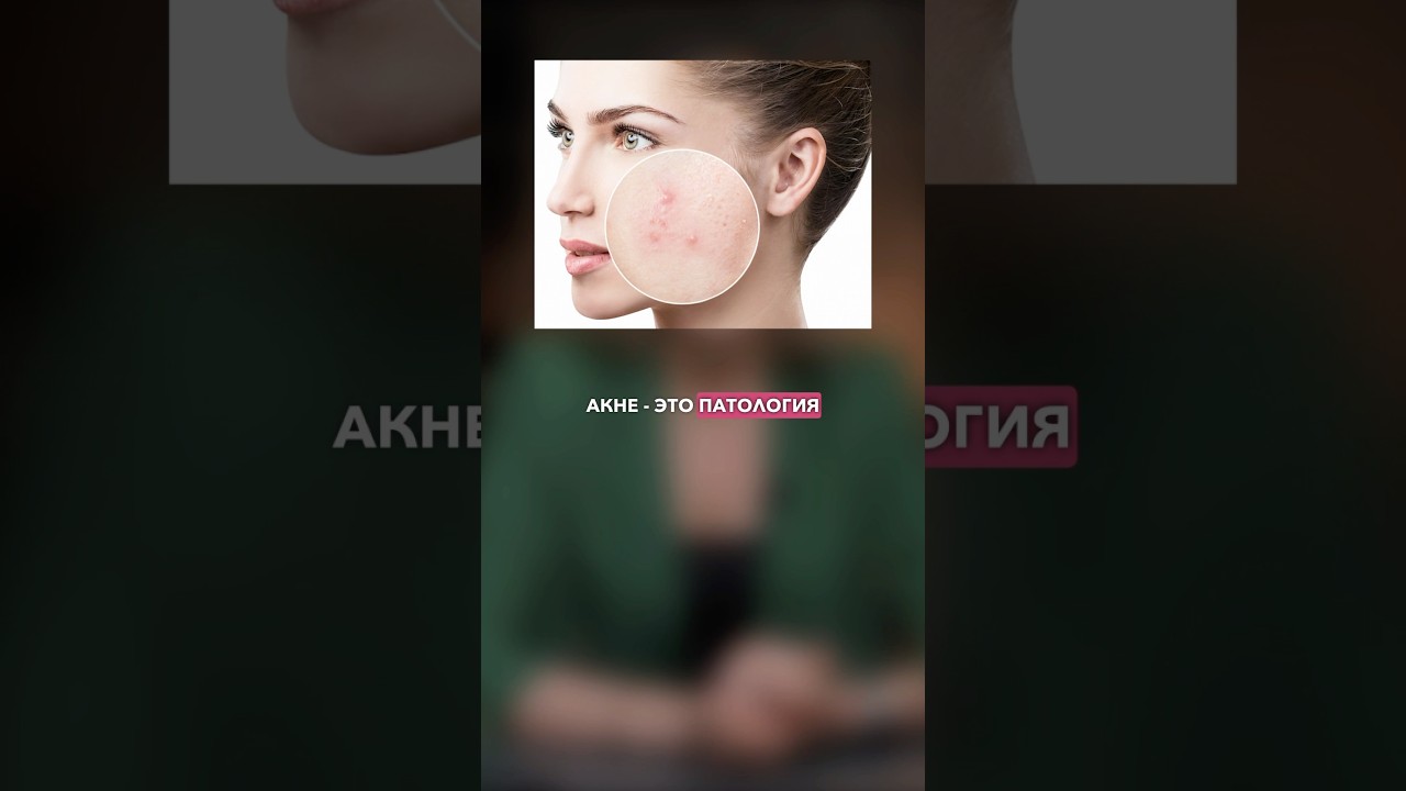 Она избавилась от прыщей с помощью этих таблеток