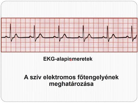 Videó: Az Elektronikus Konfiguráció Meghatározása