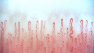 Optilia Video Nailfold Capillaroscopy