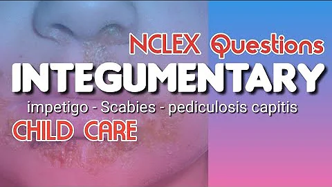 Integumentary Sample Questions | Child Care | NCLEX Practice Test