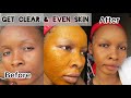 How To Fade Scars &amp; Get Clear, Even &amp; Acne Free Skin Using Turmeric Face Mask