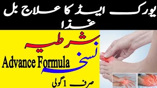 Uric Acid Treatment . Uric Acid ka Ilaj in Urdu (یورک ایسڈ کا علاج بل غذا)